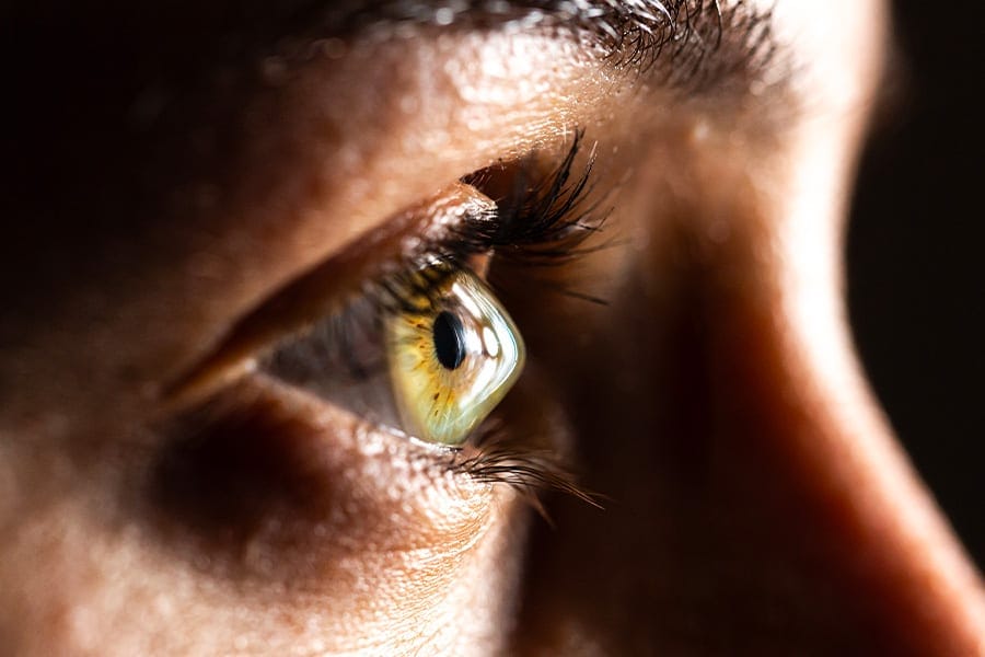 anneaux intracorneens thomas adam chirurgien ophtalmologue specialiste chirurgie refractive keratocone la reunion