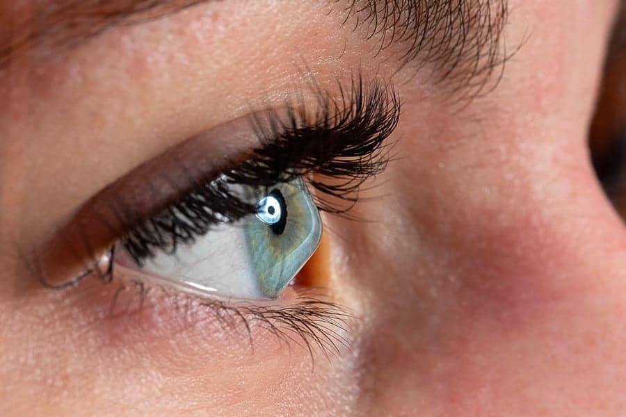 keratocone yeux thomas adam chirurgien ophtalmologue specialiste chirurgie refractive keratocone la reunion