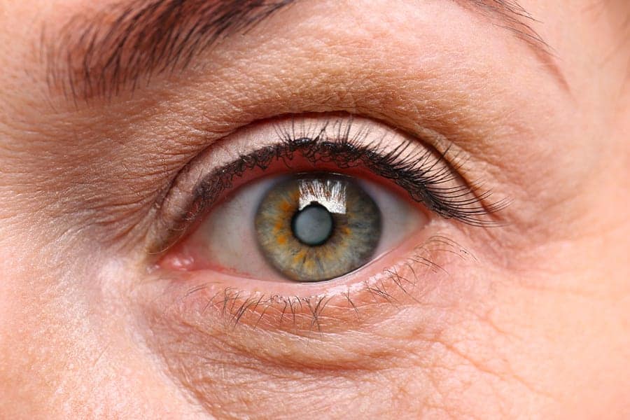 cataracte docteur thomas adam chirurgien ophtalmologue specialiste chirurgie refractive keratocone la reunion