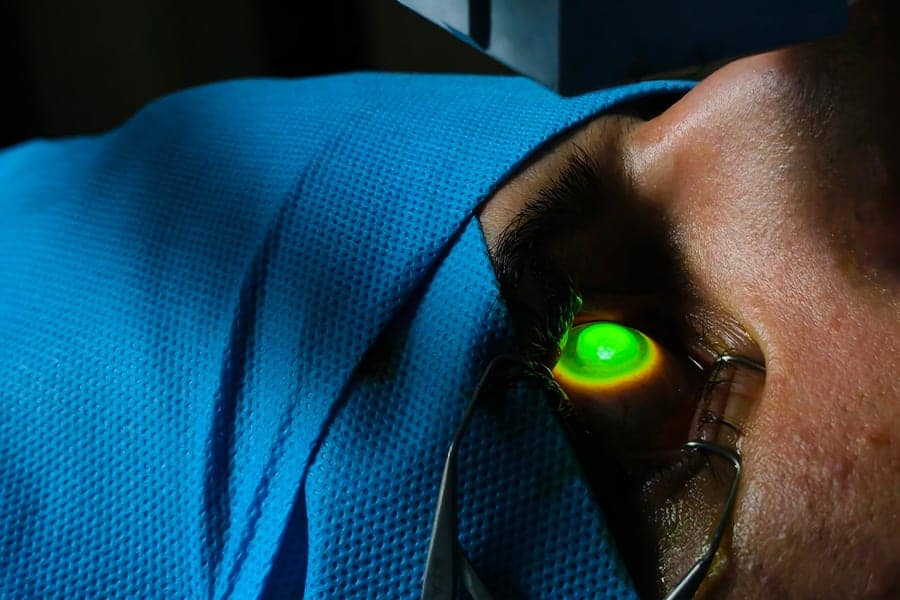 keratocone traitement cross linking thomas adam chirurgien ophtalmologue specialiste chirurgie refractive keratocone la reunion